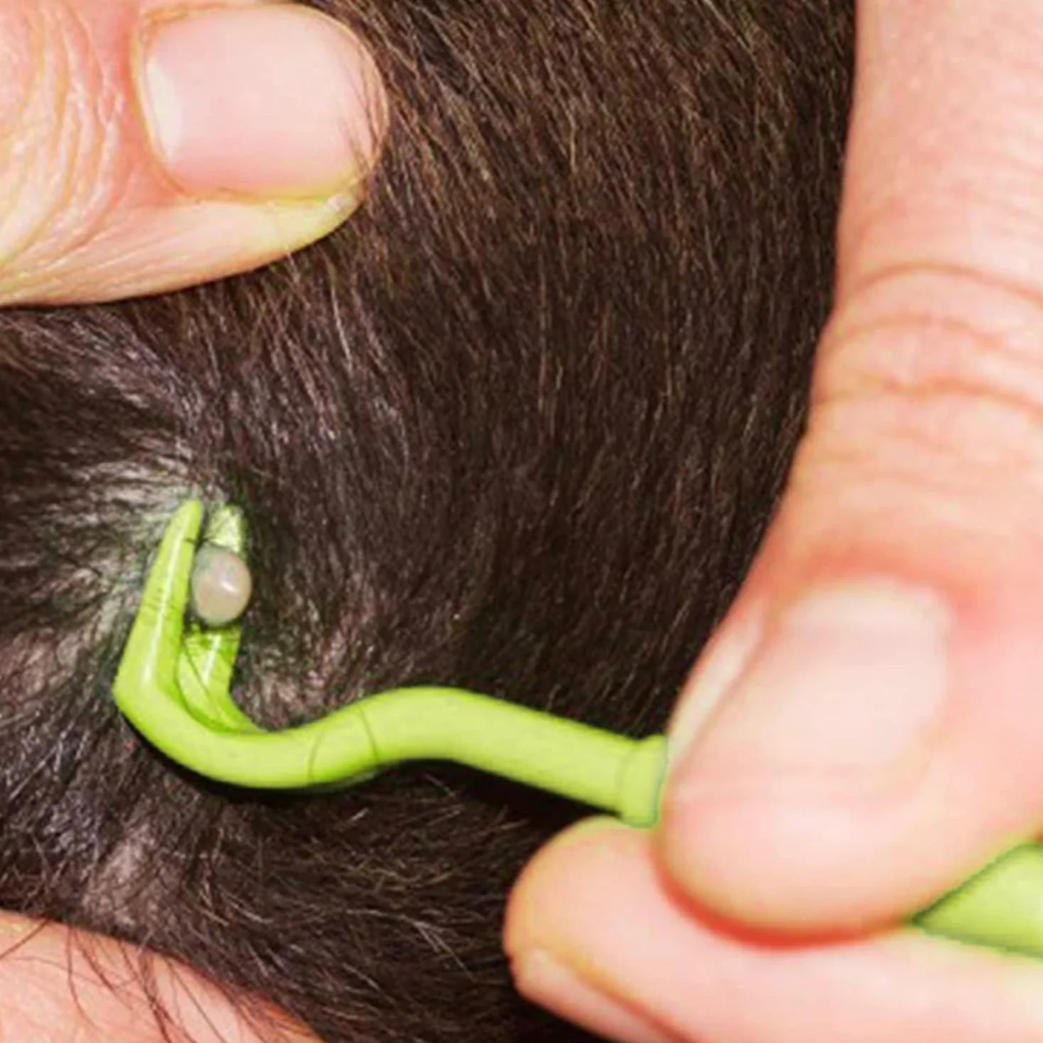 GeekerChip 3 Pièces Pince à Tiques Anti-Tique pour Chiens Chats Vert